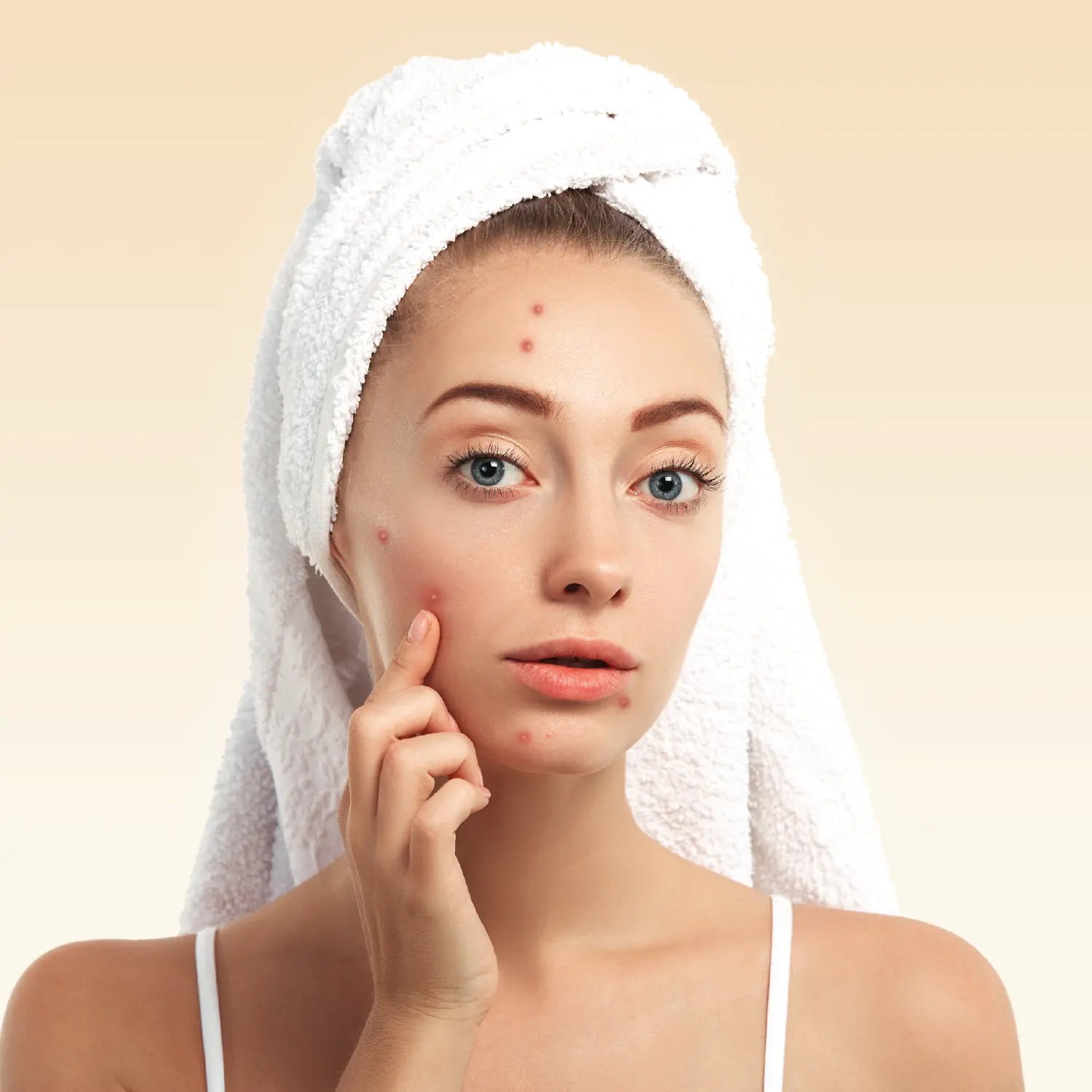 Anti-Acne Skincare Products - Pilgrim
